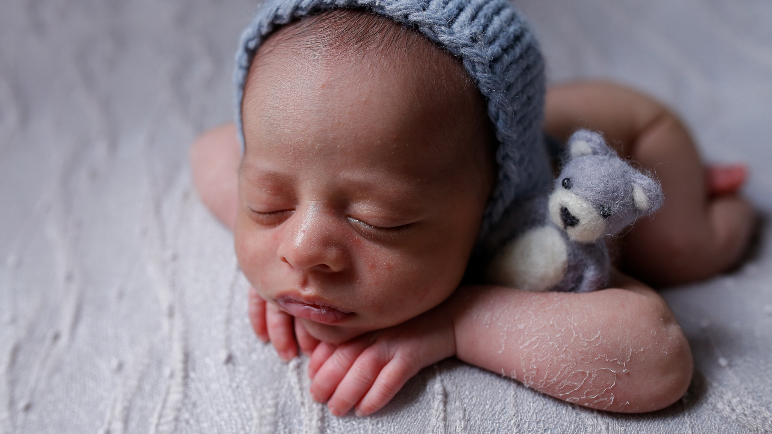 Foto de um recém-nascido dormindo com um gorro azul e segurando um ursinho de pelúcia, apresentando pele descamando e acne neonatal, antes da pós-produção fotográfica de carla toscano pós-produção fotográfica.