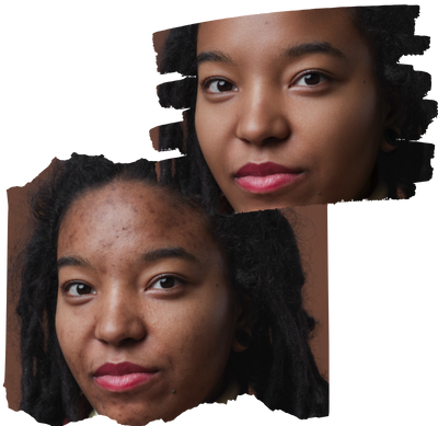 Comparação antes e depois de edição de pele em retrato com evoto ai